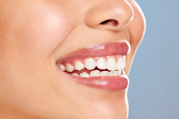 FAQs On Take Home Teeth Whitening Trays