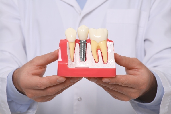 Tooth Restoration Options From An Implant Dentist